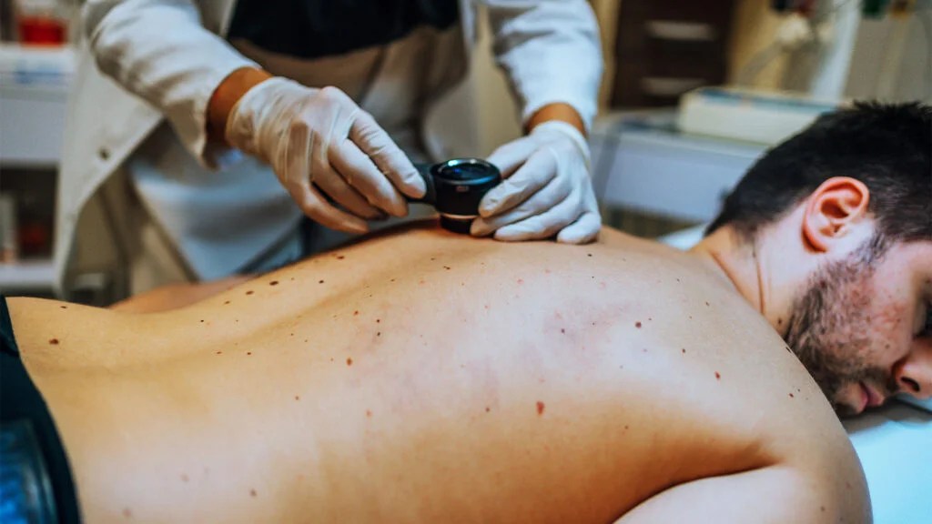 A doctor checks moles on the back of a man